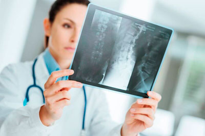 diagnostika osteoporoza